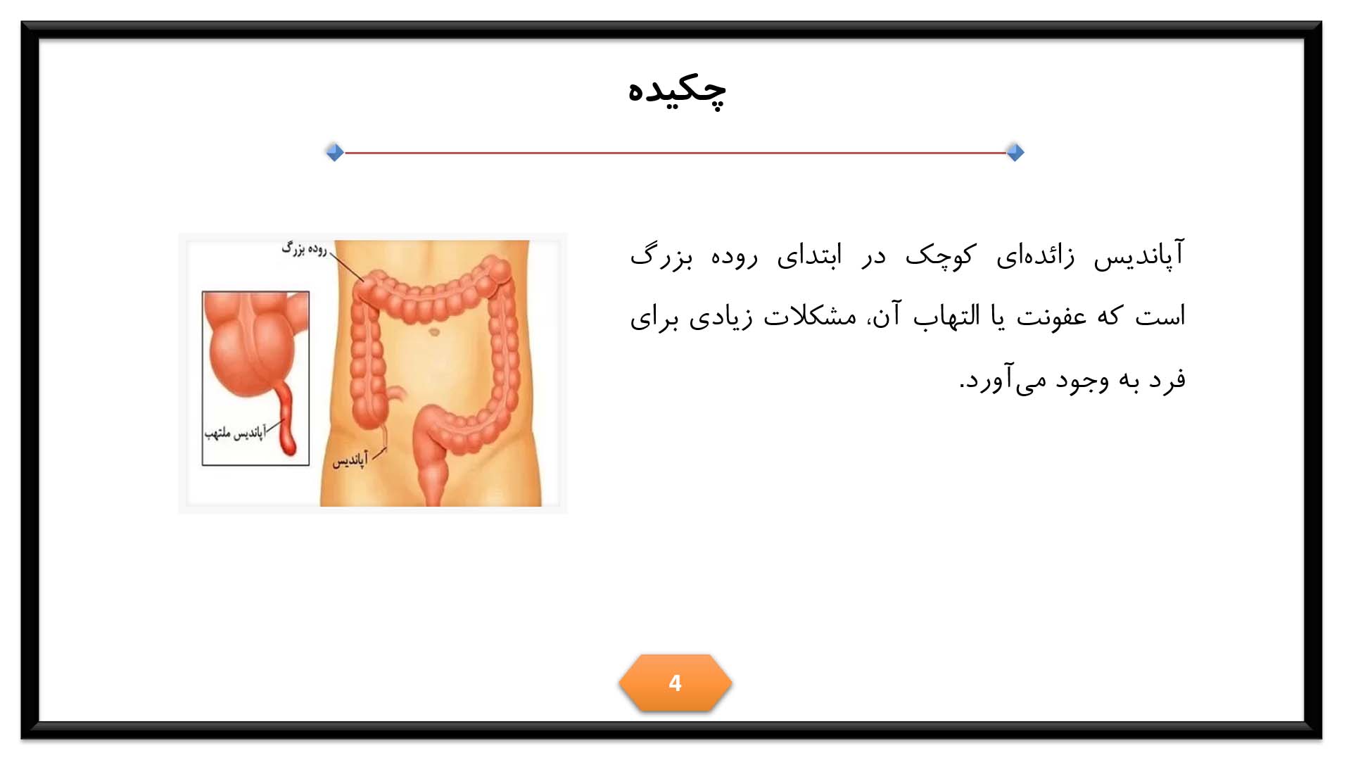 پاورپوینت در مورد آپاندیس 